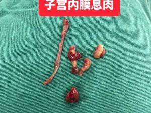 老中医李雪妮排阴毒，排出血块、肌瘤、囊肿、息肉，还你健康身体